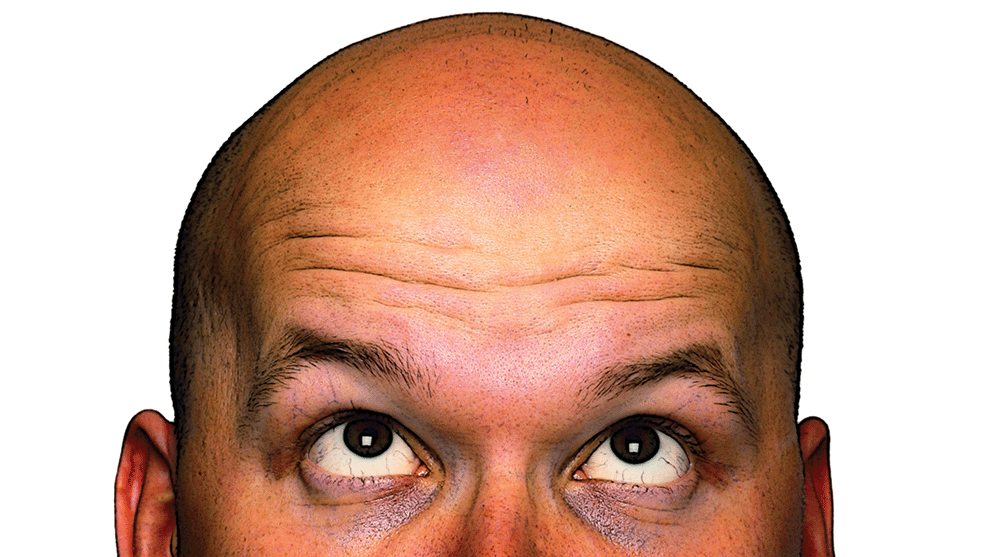 The Roots of Hair Loss – The University of Utah Magazine